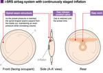 Honda i SRS Airbag